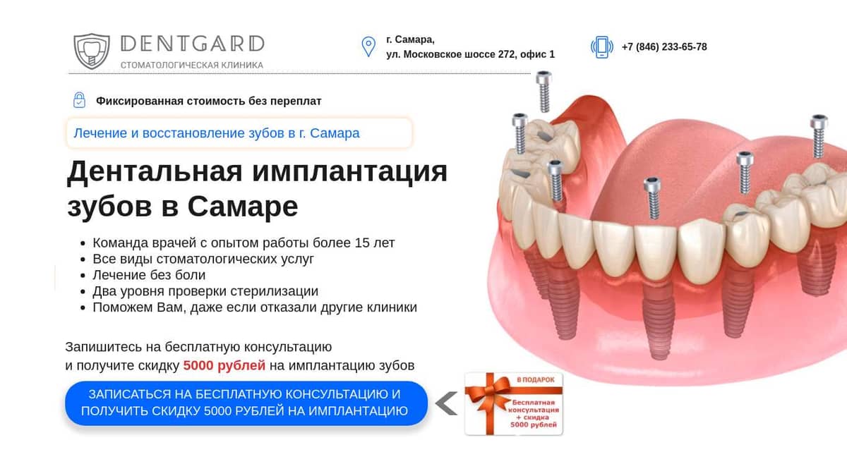 Имплантация Зубов Стоимость К31